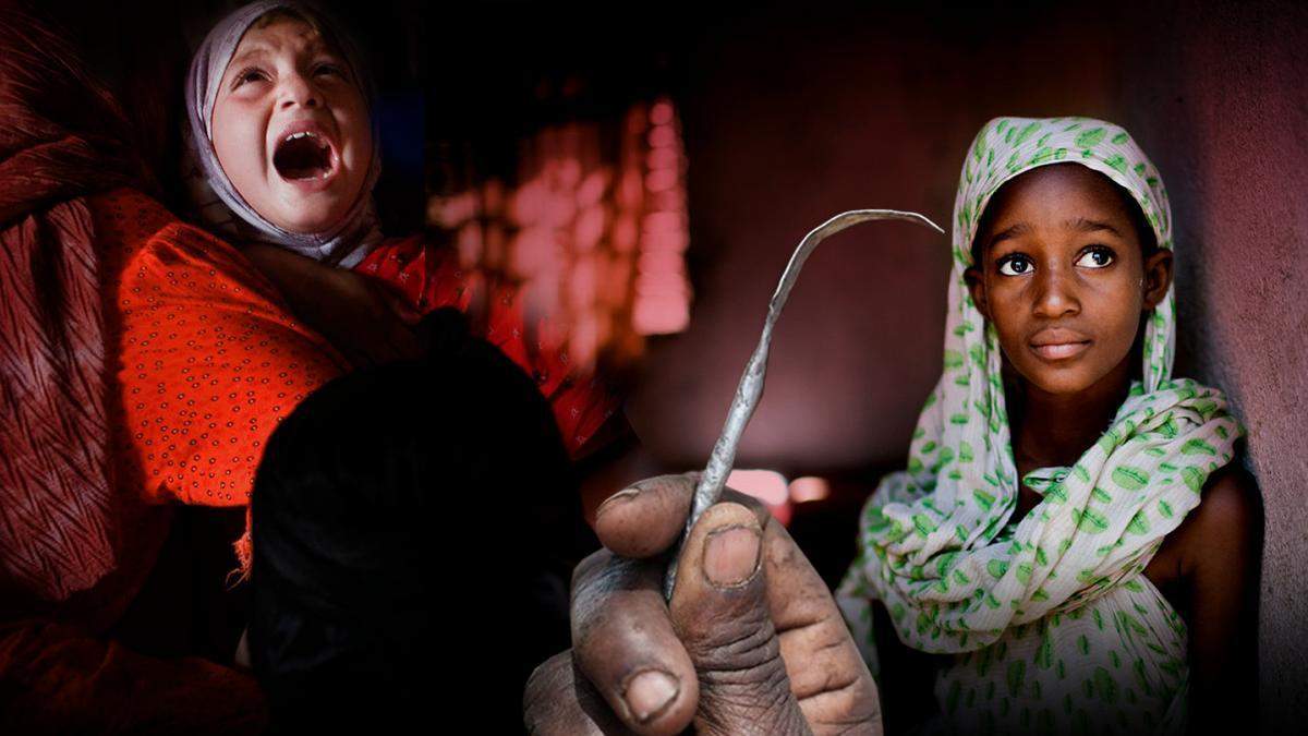 Что такое женское обрезание у мусульман фото