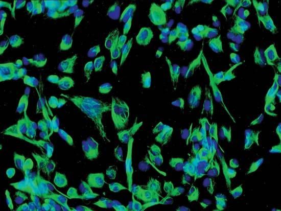 Вчені змогли відновити клітини слухового нерву