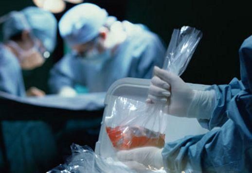 Експерт: Донорство органів може прискорити смерть багатьох людей