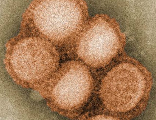 У Польщі свинячий грип: померло двоє людей