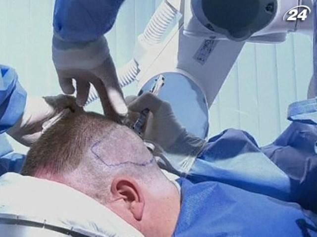 Британський робот вирішує проблему облисіння за кілька годин Британський робот вирішує проблему облисіння за кілька годин