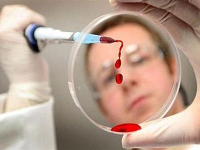 В Грузии от свиного гриппа умер уже пятый человек
