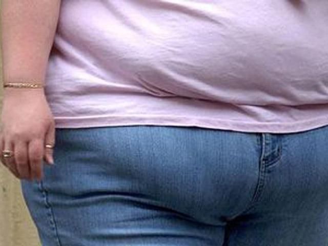 Из бюджета США выделили 1,5 миллиона на исследования лишнего веса у лесбиянок