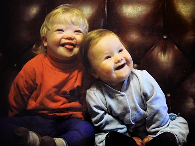 Сьогодні світ відзначав День людей із синдромом Дауна Сьогодні світ відзначав День людей із синдромом Дауна