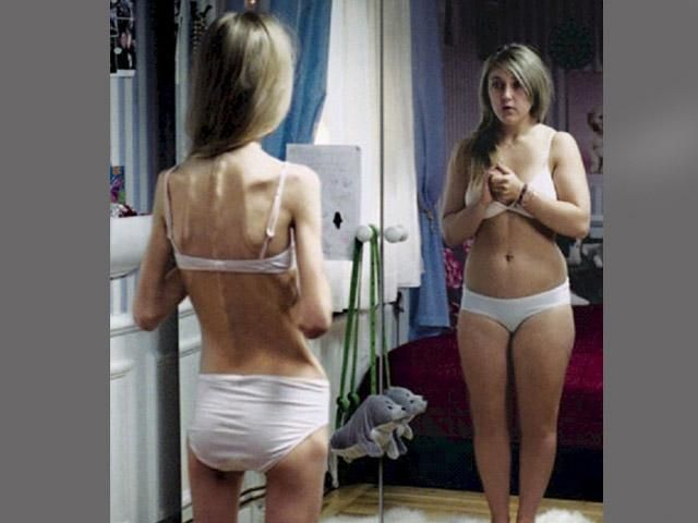 Каждая двадцатая женщина на грани анорексии Каждая двадцатая женщина на грани анорексии