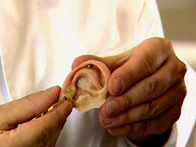 Екстремальна хірургія. Як виростити орган в пробірці, пересадити серце чи гортань Екстремальна хірургія. Як виростити орган в пробірці, пересадити серце чи гортань