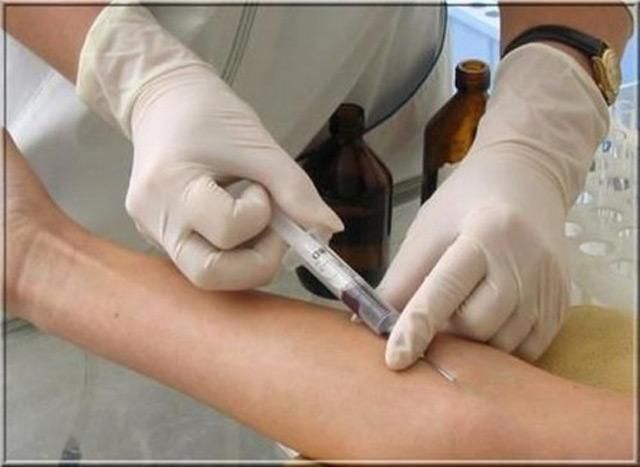 17 житомирян попали в больницу с гепатитом 17 житомирян попали в больницу с гепатитом