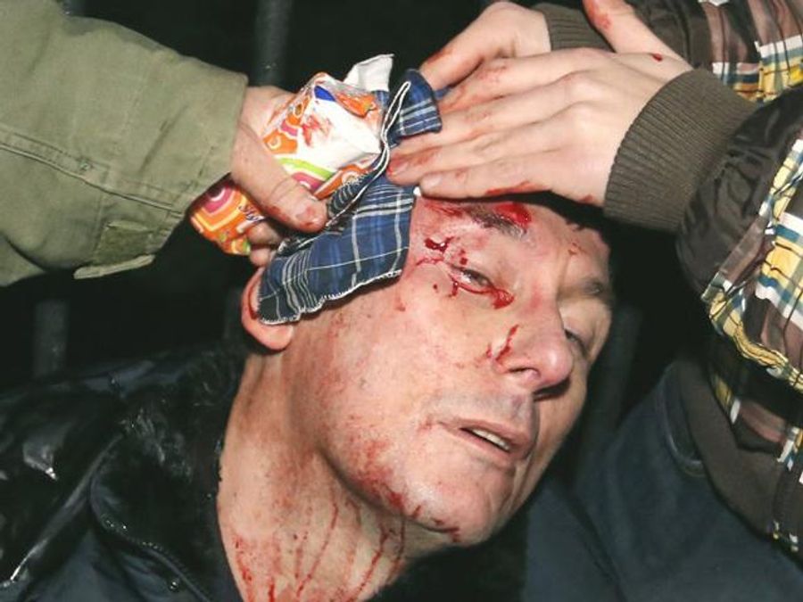 У Луценка брали аналіз на вміст алкоголю в крові, щоб визначитися з лікуванням - 14 січня 2014 - Телеканал новин 24