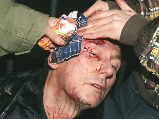 У Луценка брали аналіз на вміст алкоголю в крові, щоб визначитися з лікуванням - 14 січня 2014 - Телеканал новин 24 У Луценка брали аналіз на вміст алкоголю в крові, щоб визначитися з лікуванням - 14 січня 2014 - Телеканал новин 24