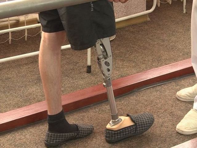 На протезування учасники АТО збирають гроші самотужки На протезування учасники АТО збирають гроші самотужки