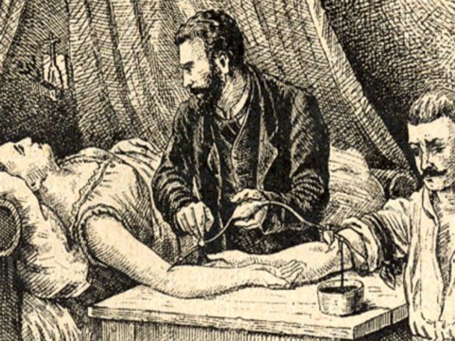 196 лет назад провели первую успешную операцию по переливанию крови 196 лет назад провели первую успешную операцию по переливанию крови