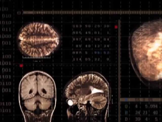 Факти про здоров'я: двоє з трьох людей мають депресію Факти про здоров'я: двоє з трьох людей мають депресію