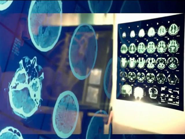 Факти про здоров'я. Чи допоможуть ліки позбутися головного болю? Факти про здоров'я. Чи допоможуть ліки позбутися головного болю?