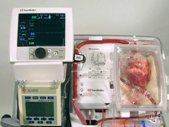 Австралійські хірурги пересадили трьом хворим серця померлих людей