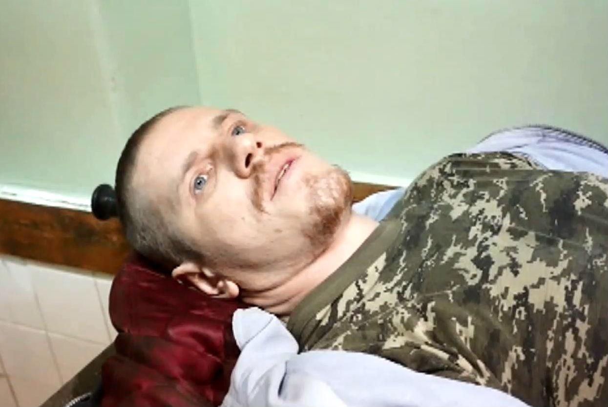 "Кіборг" розповів про лікування у полоні "Кіборг" розповів про лікування у полоні