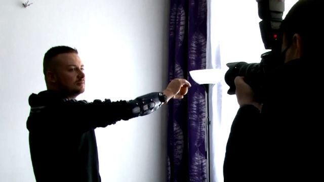 Австрійські лікарі розробили штучну руку, якою можна керувати силою думки Австрійські лікарі розробили штучну руку, якою можна керувати силою думки