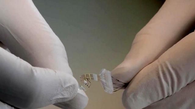 Науковці розробили хребетний імплантат, який допоможе з паралічем Науковці розробили хребетний імплантат, який допоможе з паралічем