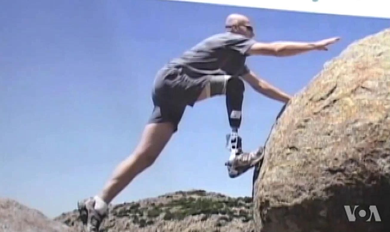 Иностранные врачи прилетели в Украину, чтобы бесплатно протезировать бойцов АТО Иностранные врачи прилетели в Украину, чтобы бесплатно протезировать бойцов АТО