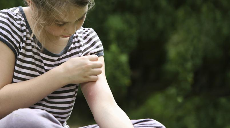 7 способов избавиться комаров с помощью запахов