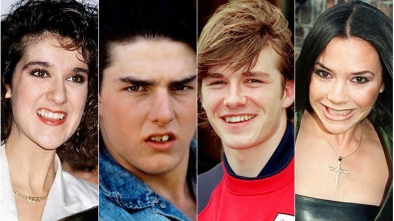 Як голлівудські зірки виправили свої кривозубі посмішки Як голлівудські зірки виправили свої кривозубі посмішки