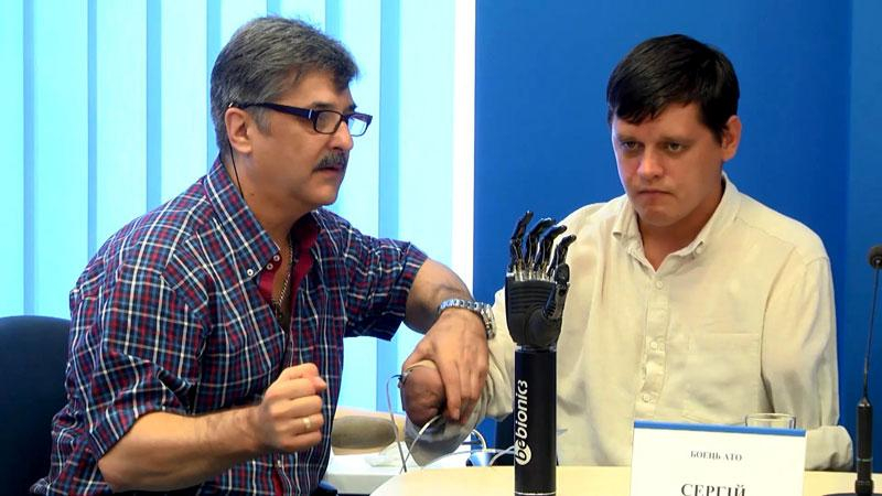 Украинским бойцам обещают протезы нового поколения