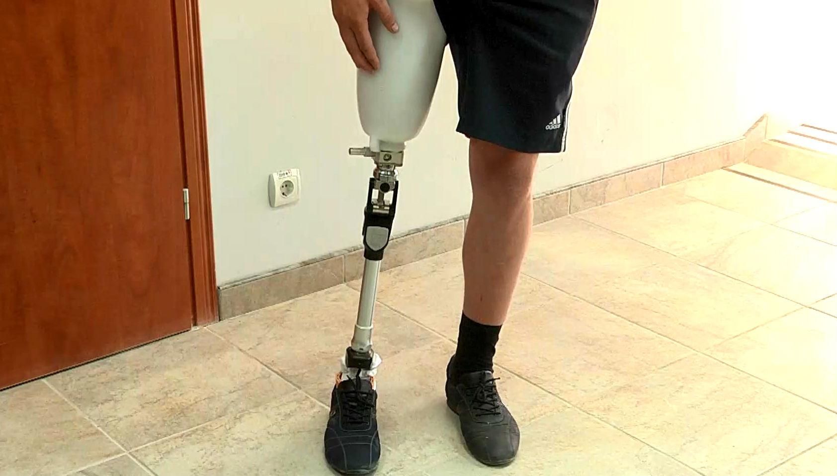 Протезувати українських бійців допоможе Ісландія Протезувати українських бійців допоможе Ісландія