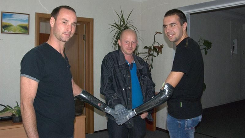 Бійцям АТО зробили протези в Італії Бійцям АТО зробили протези в Італії