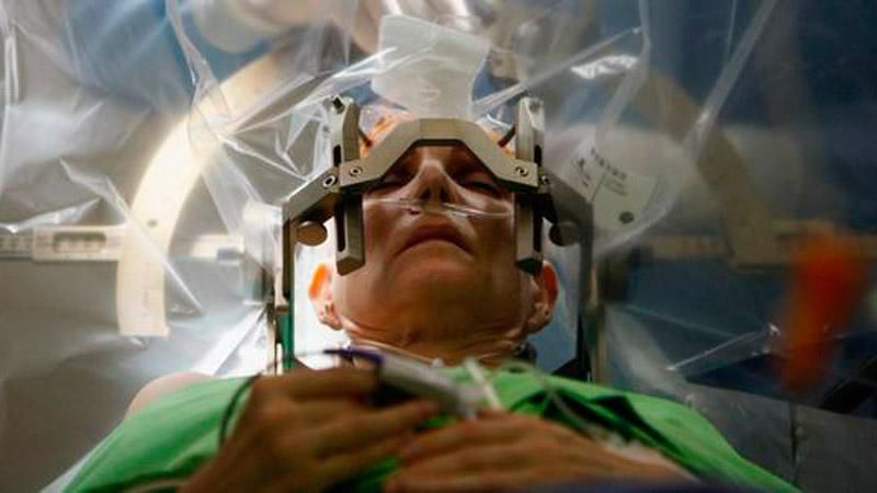 Операцию на мозге покажут в прямом эфире Операцию на мозге покажут в прямом эфире