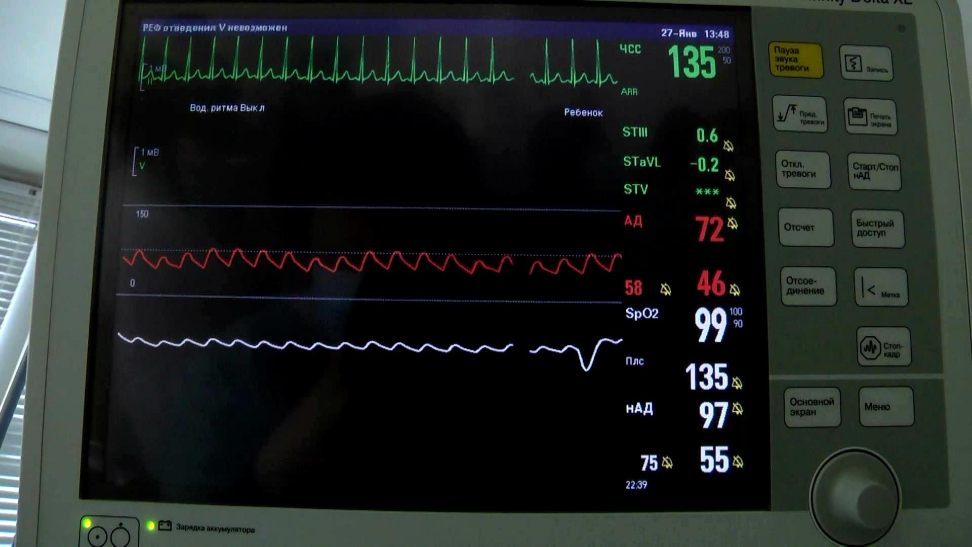 Украинская медицина получила инновационное изобретение для спасения младенцев Украинская медицина получила инновационное изобретение для спасения младенцев