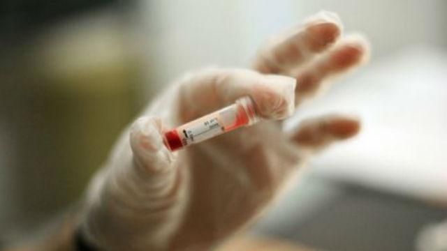 Вірус Зіка передається через секс — зафіксували перший випадок Вірус Зіка передається через секс — зафіксували перший випадок