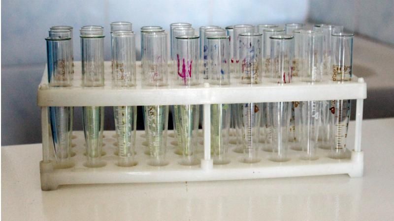 От осложнений от гриппа умерли 185 человек От осложнений от гриппа умерли 185 человек