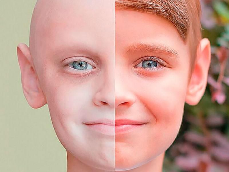 Скільки грошей потрібно українцю для лікування раку Скільки грошей потрібно українцю для лікування раку