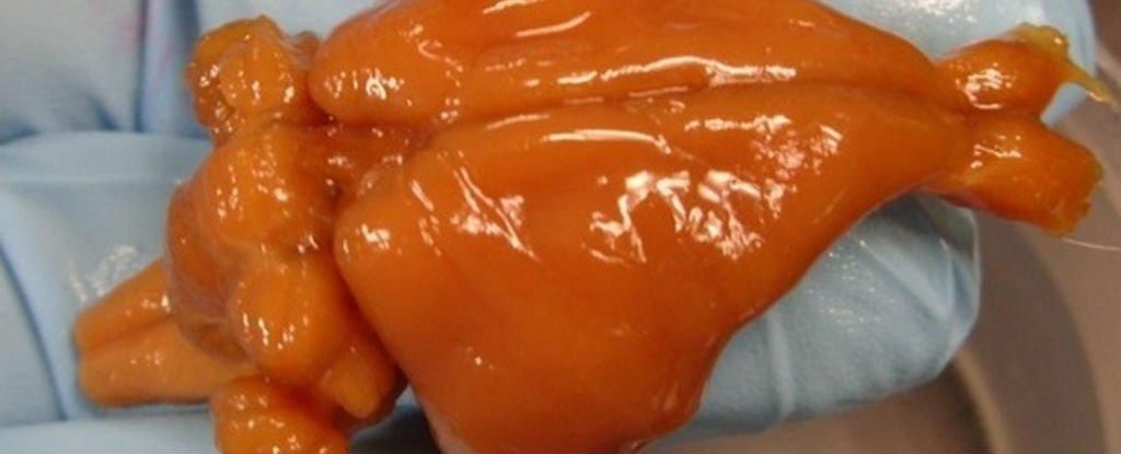 Вчені досягли нечуваного прориву у технології замороження органів Вчені досягли нечуваного прориву у технології замороження органів