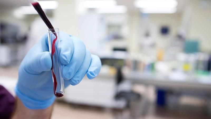 Вірус Зіка передається статевим шляхом: перший випадок у Європі Вірус Зіка передається статевим шляхом: перший випадок у Європі