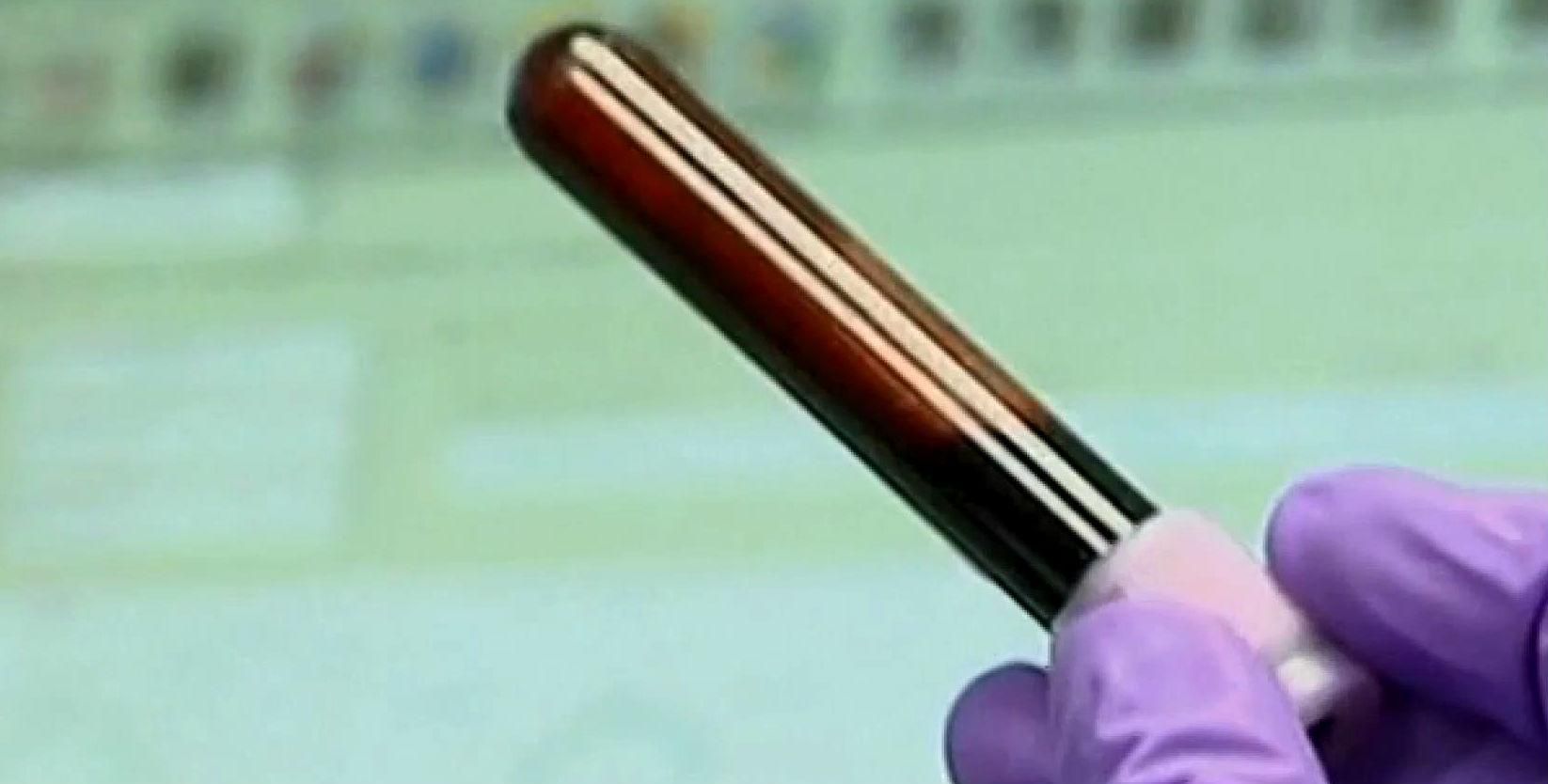 Россиян на допинг будут проверять в Украине Россиян на допинг будут проверять в Украине