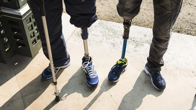 Як українські бійці можуть отримати протези Як українські бійці можуть отримати протези