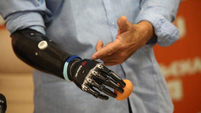 Хто в Україні гальмує протезування бійців АТО