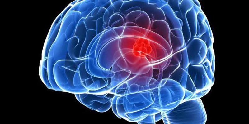 Вчені зробили несподіване відкриття щодо раку мозку
Вчені зробили несподіване відкриття щодо раку мозку