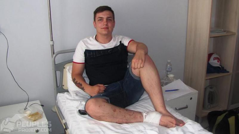 19-летнему воину АТО восстановили разбитую ногу