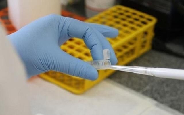 Эксперт растолковала ситуацию "вокруг" заболеваний холерой