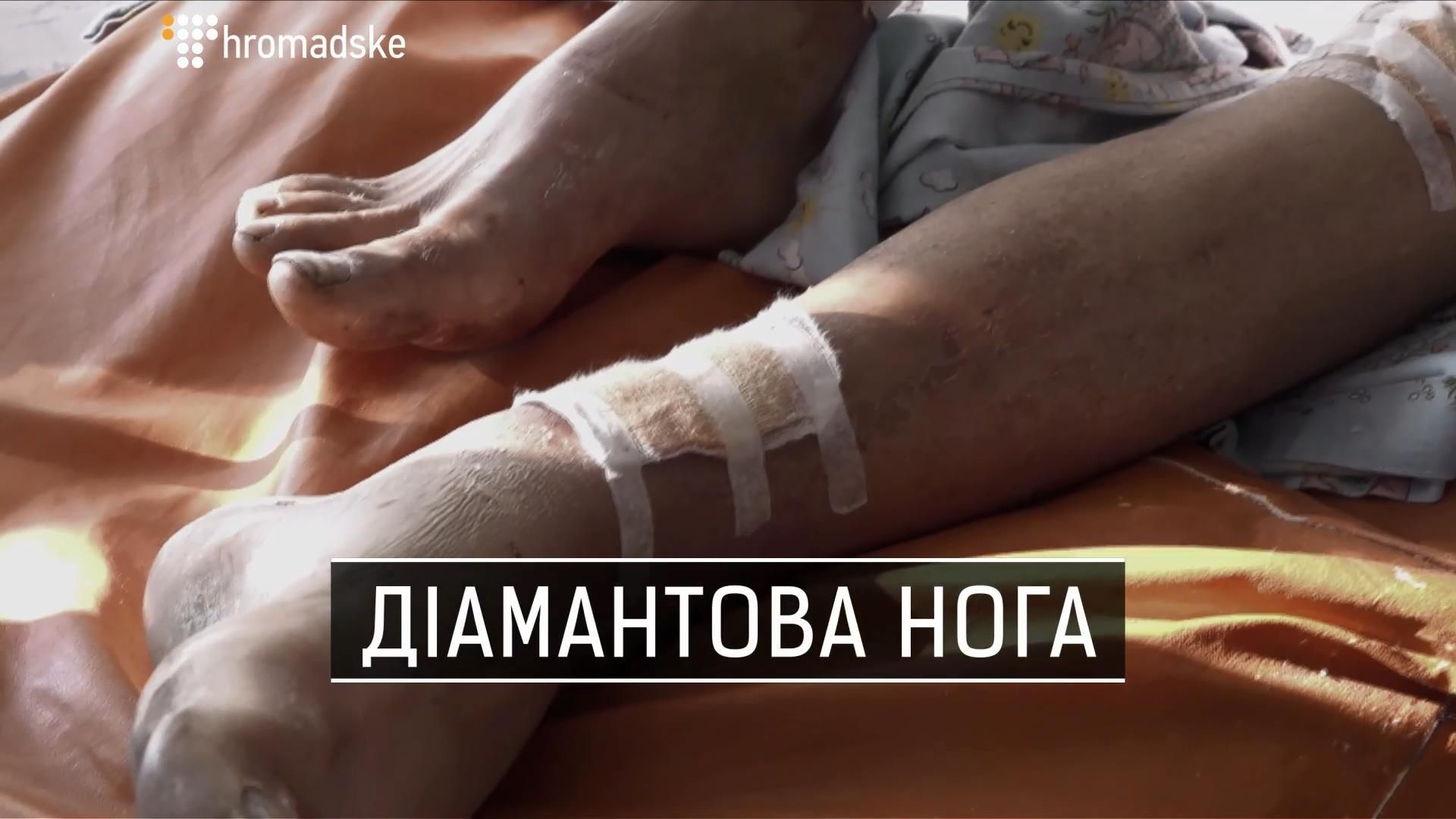 Як лікарська мафія наживається на пацієнтах, які потрапили у скруту Як лікарська мафія наживається на пацієнтах, які потрапили у скруту