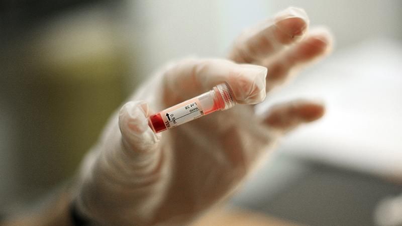 Вірус Коксакі в Україні: його причини та лікування Вірус Коксакі в Україні: його причини та лікування