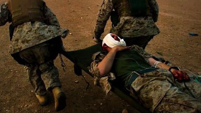 Українські воїни постраждали внаслідок обстрілу терористів на Луганщині Українські воїни постраждали внаслідок обстрілу терористів на Луганщині