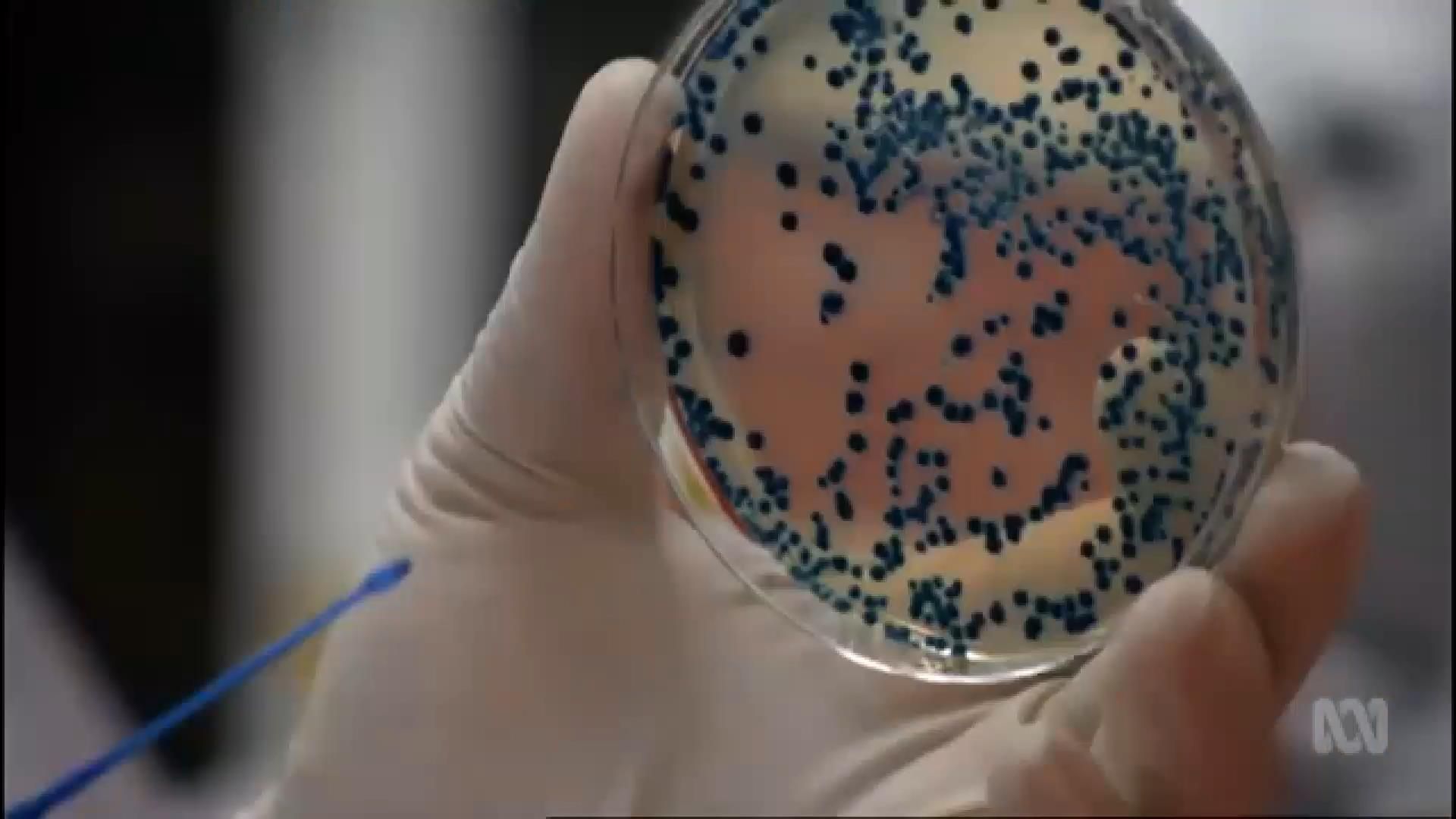 Заражена надстійкою до антибіотиків бактерією жінка померла у США