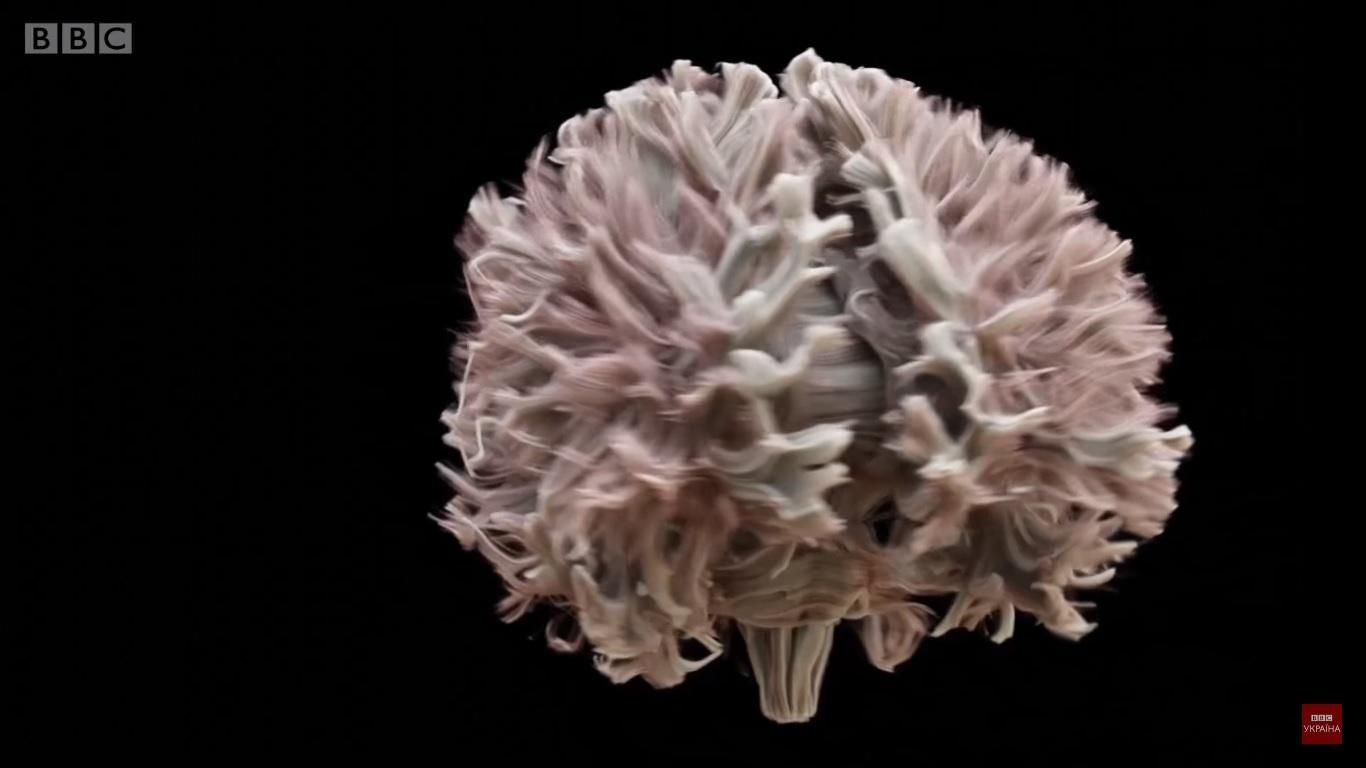 Вчені показали найдетальніше зображення головного мозку: вражаюче відео