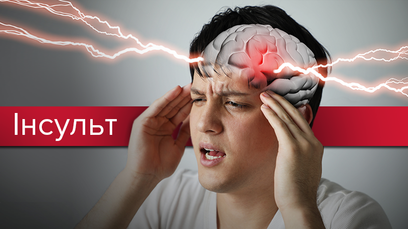 Инсульт - симптомы, первая помощь, причины и как распознать