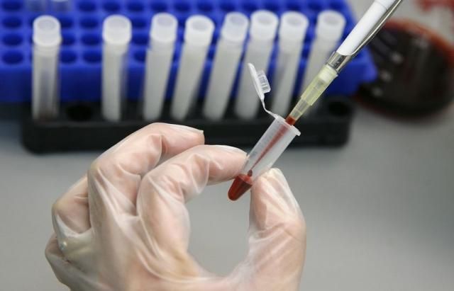 Гепатит А в Николаеве: 37 человек подцепили гепатит