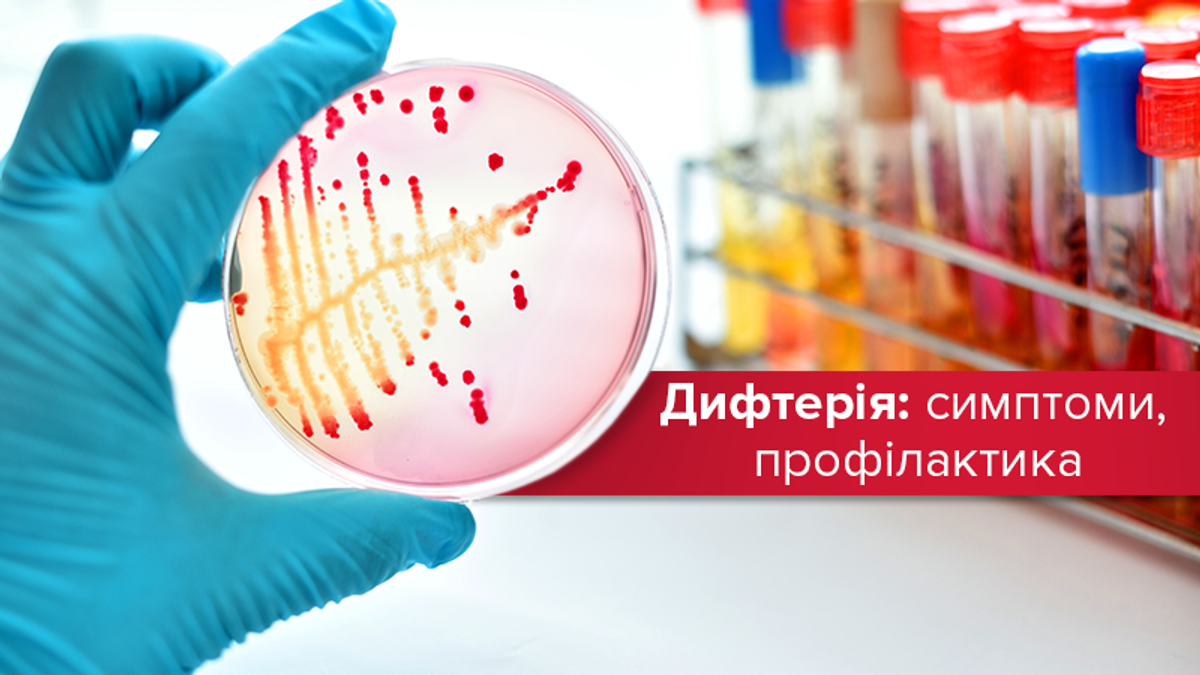 Дифтерия в Украине 2019 – как распознать и лечить дифтерию: у детей и взрослых Дифтерия в Украине 2019 – как распознать и лечить дифтерию: у детей и взрослых