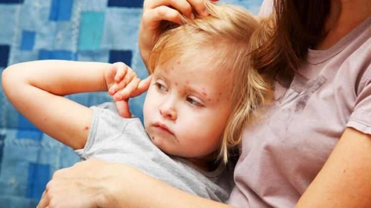 Небезпечний кір дістався "ДНР": терористи натякають на вину України Небезпечний кір дістався "ДНР": терористи натякають на вину України