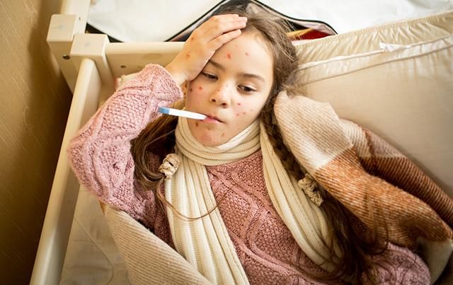 Корь в Украине 2018: уже 930 больных на корь Корь в Украине 2018: уже 930 больных на корь